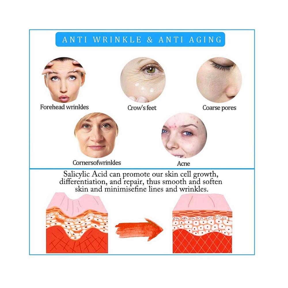 SalicylicI Acid 2% Serum Mild Peel Acne Scrs Clarifying Pores Sebum