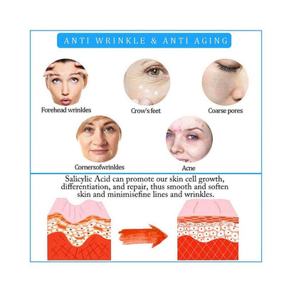 SalicylicI Acid 2% Serum Mild Peel Acne Scrs Clarifying Pores Sebum