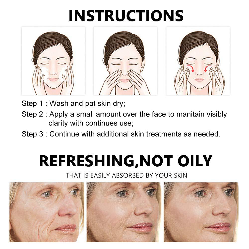 SalicylicI Acid 2% Serum Mild Peel Acne Scrs Clarifying Pores Sebum