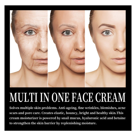 Snail Cream Fading Wrinkle French Lines Replenishment Firming Skin